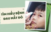 ảnh tuyên truyền đau mắt đỏ