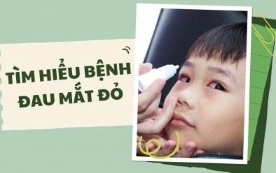 ảnh tuyên truyền đau mắt đỏ